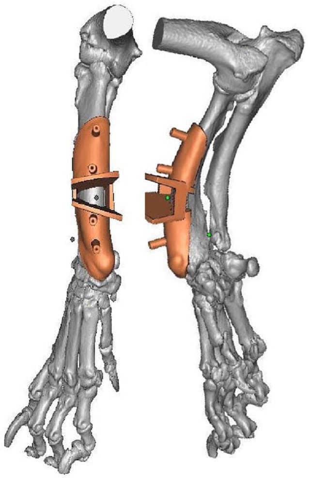 Fig 1: Computer simulation of the surgical guide on the dorsal aspect of the radius