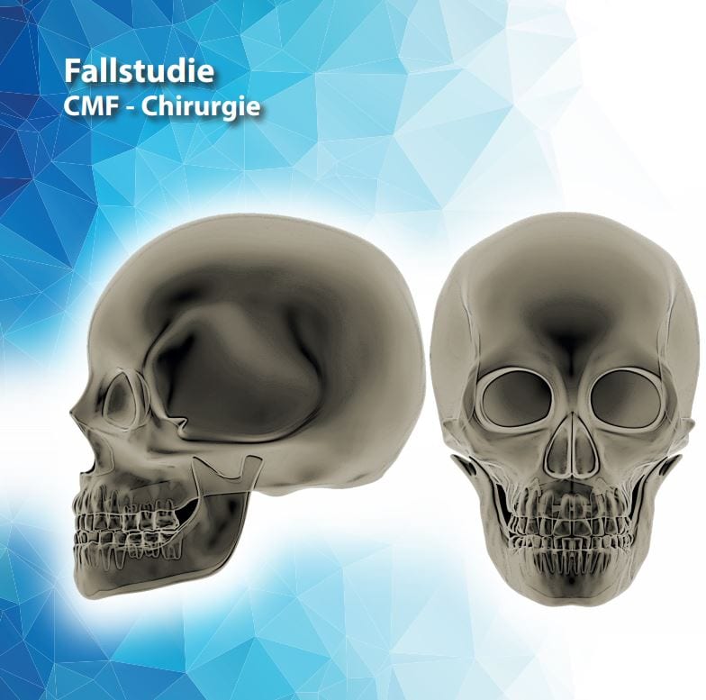 Cover CMF Chirurgie Fallstudie/Case Study